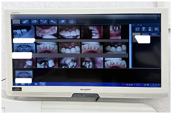 院内デジタル化